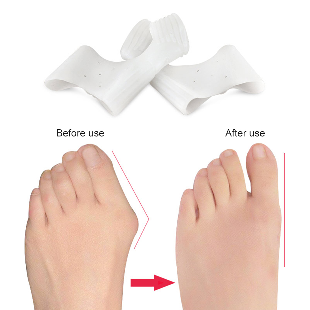 1 Çift Silikon Halluks Valgus  - Toe Separator Silicon incelemesi ve fiyatı