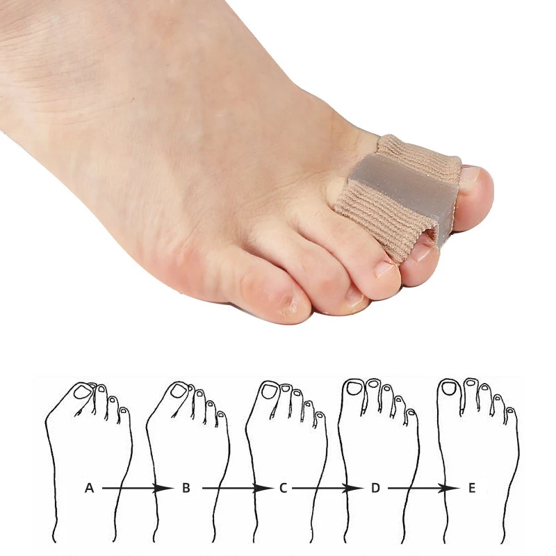Yeni Ayak Parmağı Ayırıcı Hall - Toe Separator Silicon incelemesi ve fiyatı